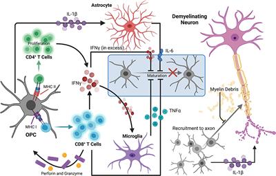 Connecting Neuroinflammation and Neurodegeneration in Multiple Sclerosis: Are Oligodendrocyte Precursor Cells a Nexus of Disease?